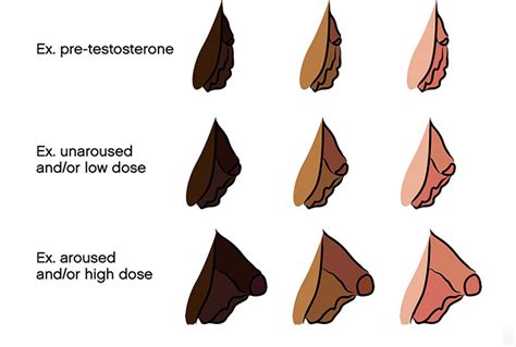 ftm bottom growth